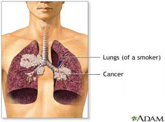 Akciğer Tedavisi nasıldır