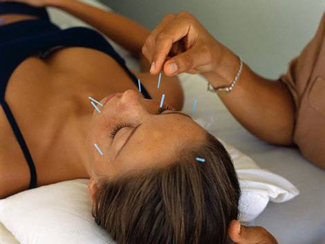 Akupunktur Diyet Listesi