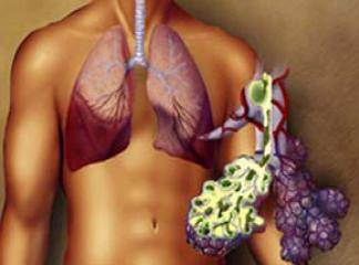 Akut akciğer ödemi tanı ve tedavisi
