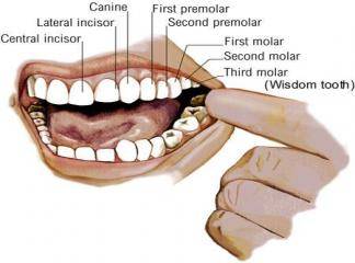 diş protezleri çeşitleri