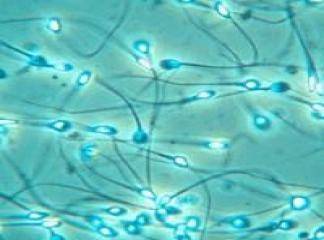 Kök Hücre Sperm