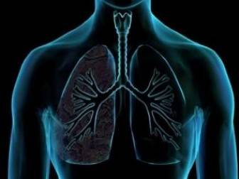 Akciğer Sertleşmesi Nasıl Tedavi Edilir