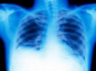 akciğer apsesi belirtileri