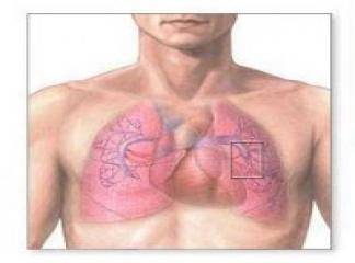 akciğer embolisi nedir tedavisi