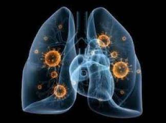 akciğer zarı iltihabı belirtileri nedir