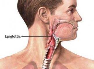Epiglotit Tedavisi