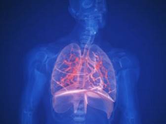 Akciğer Kanseri Nasıl Tedavi Edilebilir