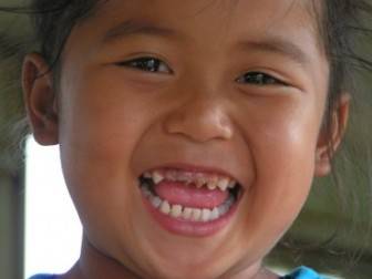 Çocuklarda Diş Çürükleri Tedavisi